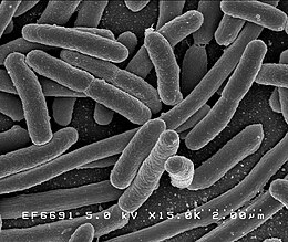 Az Escherichia coli baktérium 25 000-szeres nagyításban